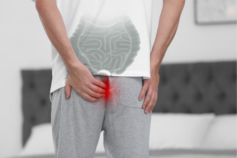 Fistula treatment