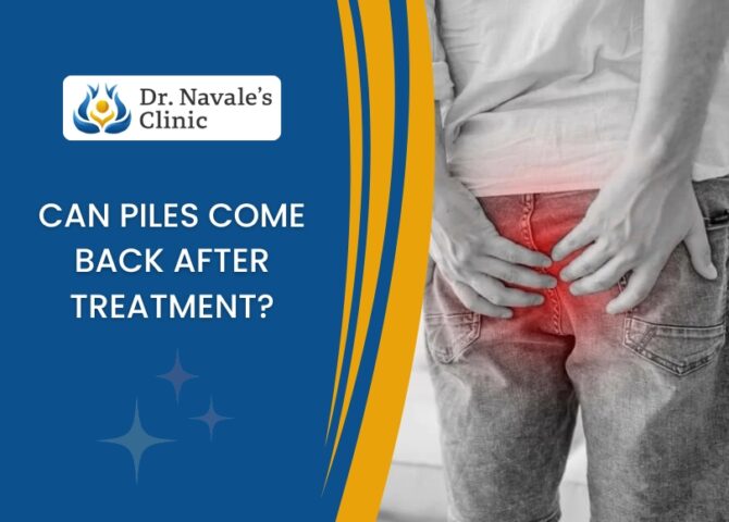 Can Piles Come Back After Treatment?