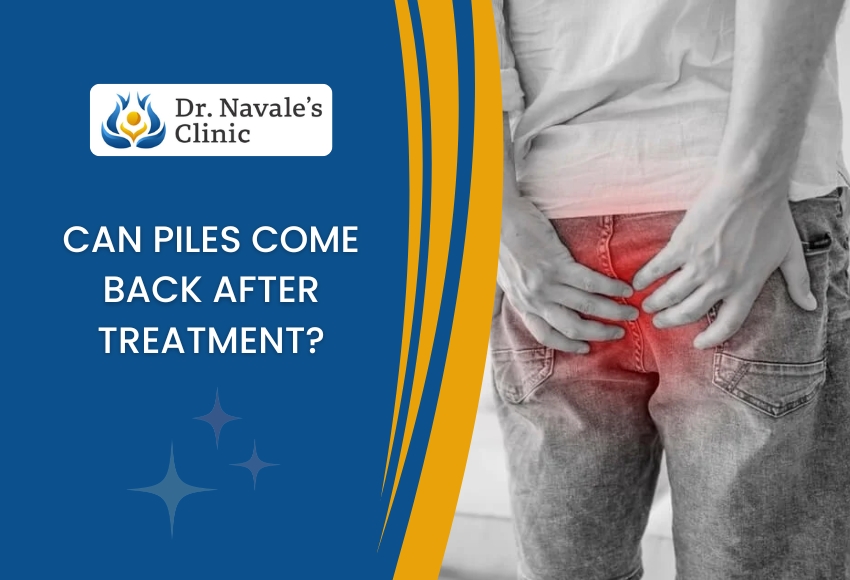 Can Piles Come Back After Treatment?