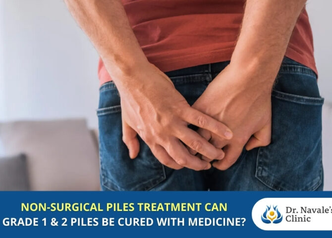 Non Surgical Piles Treatment