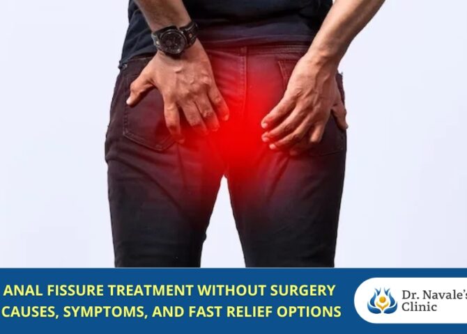 Anal Fissure Treatment