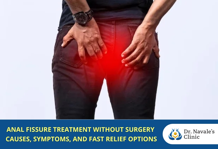 Anal Fissure Treatment