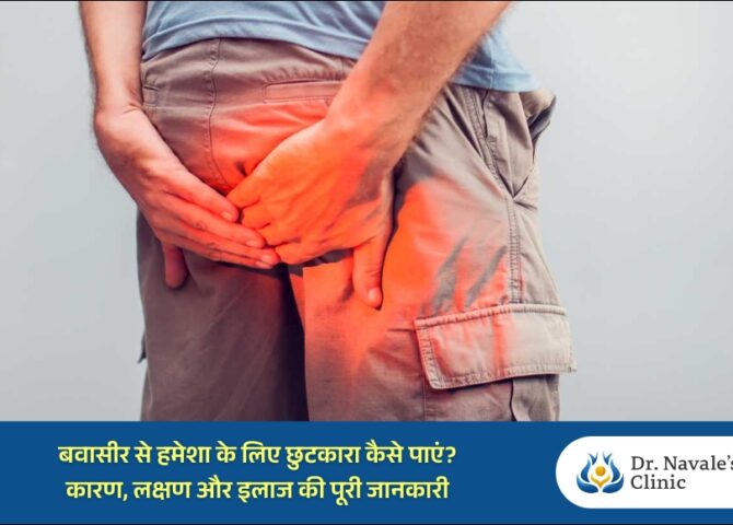 बवासीर से हमेशा के लिए छुटकारा कैसे पाएं