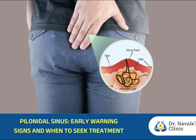 Pilonidal Sinus Treatment